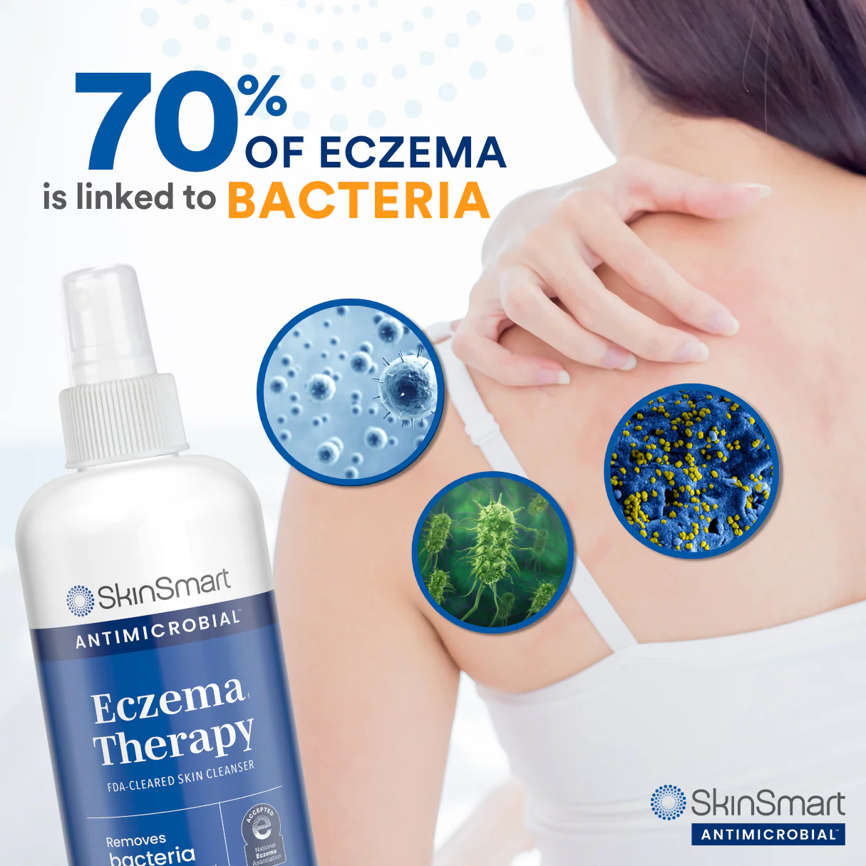 SkinSmart Antimicrobial Eczema Therapy - Image 4
